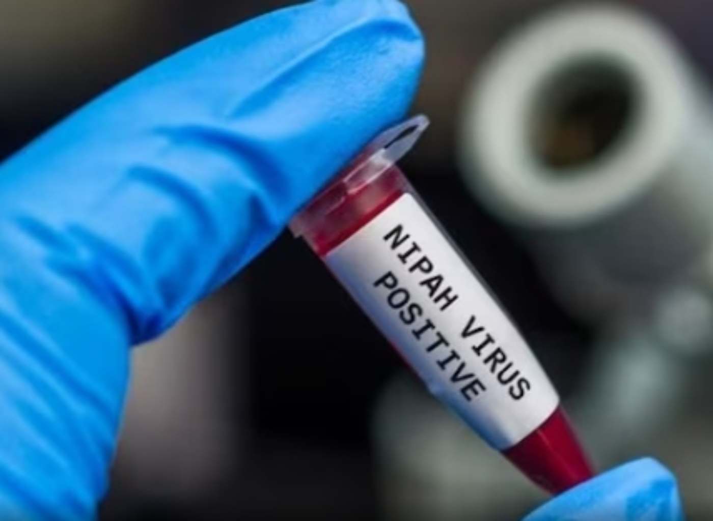 निपाह-वायरस-nipah-virus