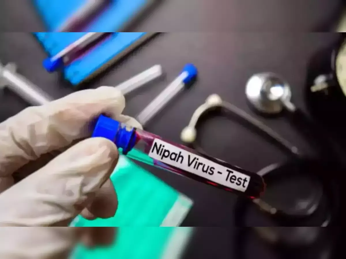 what is Nipah Virus cuases symptoms treatment