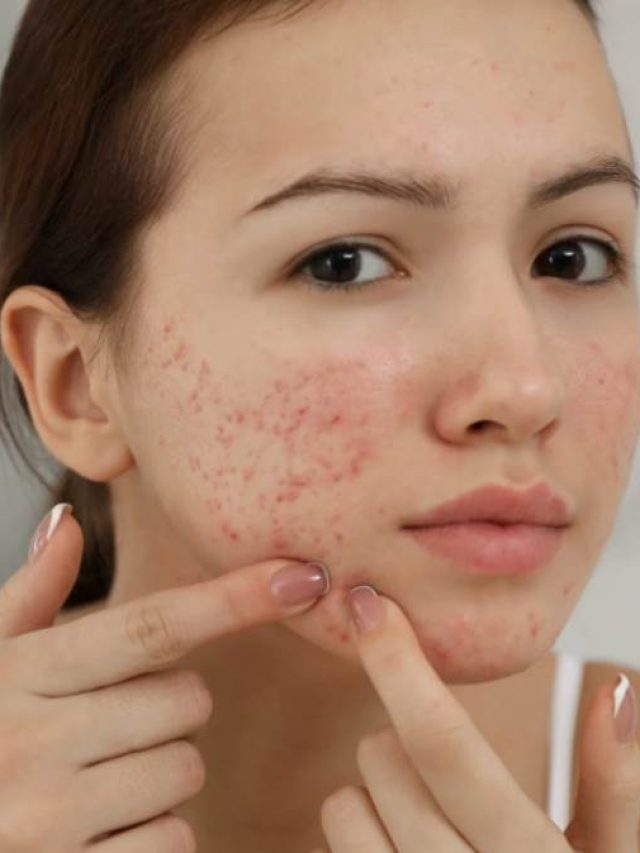 winter-skin-care-coconut-oil-benefits-on-face-daily-instant-glow