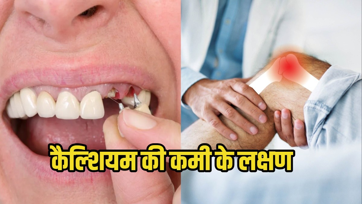 calcium deficiency symptoms